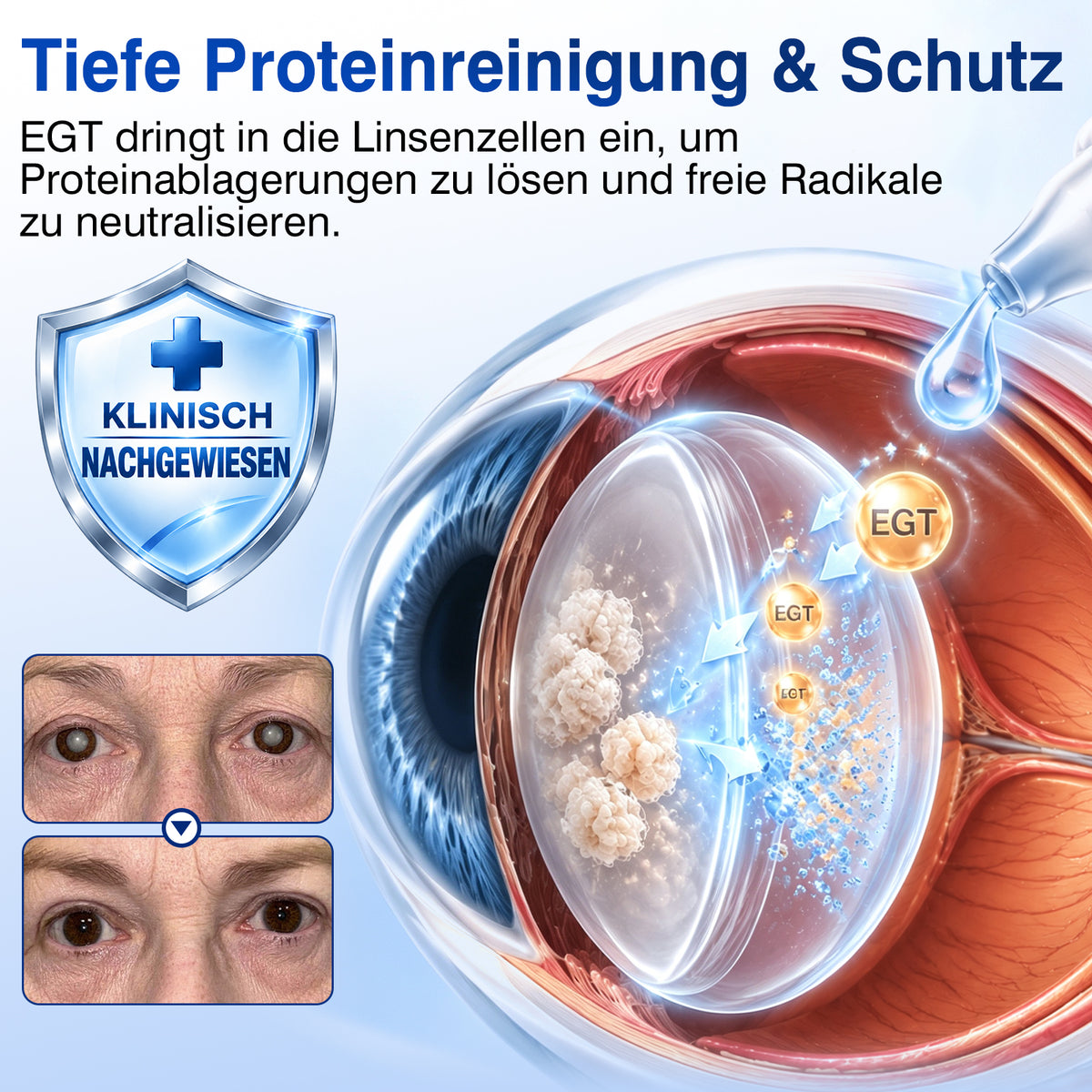 🇩🇪🎁DR.Fachmer® LensVital Nano-Augentropfen zur Linsen-Reparatur