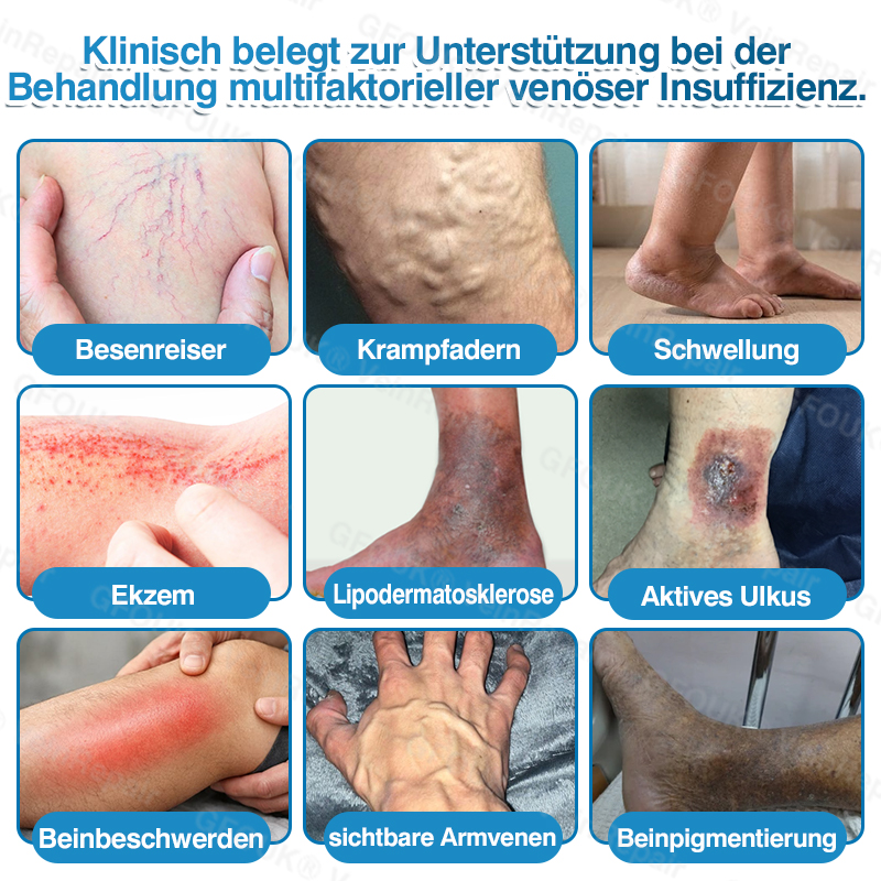 🇩🇪🏆✅️👨‍⚕️GFOUK® VeinRepair Mikronadel-Pflasterrolle⚡Sofortige Linderung, langfristige Ergebnisse