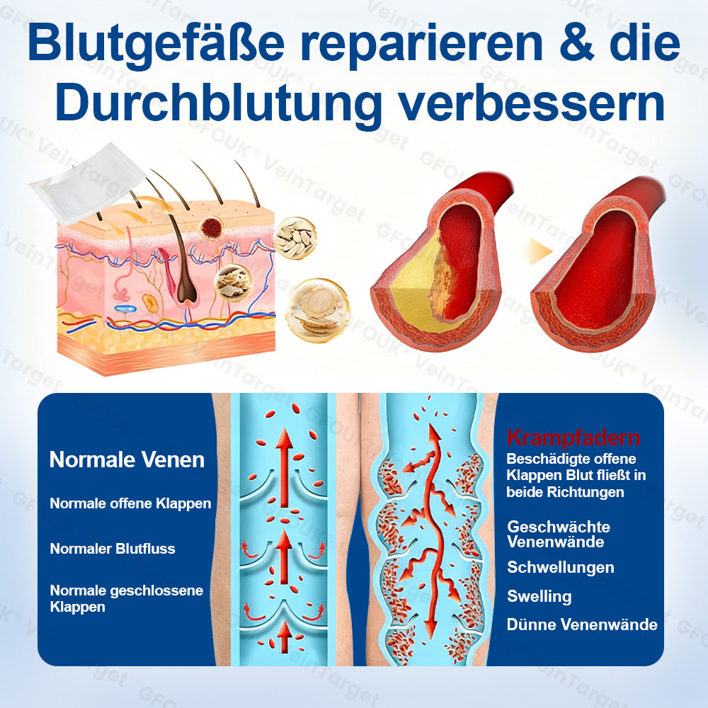 🇩🇪👨‍⚕️✅✅GFOUK® VeinTarget Mikronadel-Pflaster⚡Sofortige Linderung, langfristige Ergebnisse