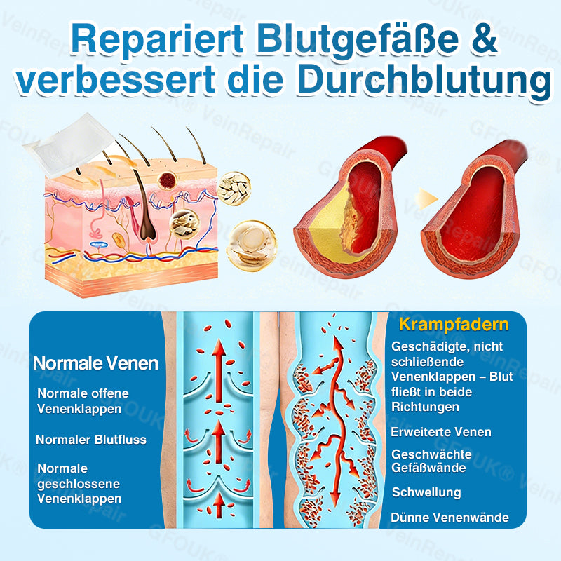 🇩🇪🏆✅️👨‍⚕️GFOUK® VeinRepair Mikronadel-Pflasterrolle⚡Sofortige Linderung, langfristige Ergebnisse