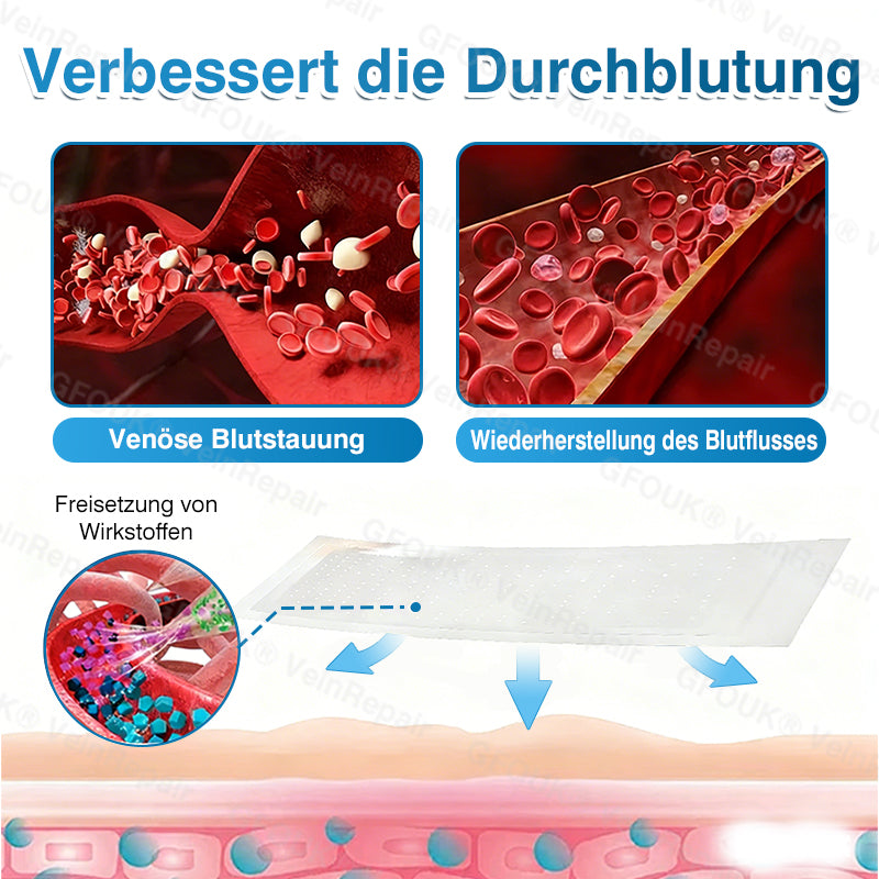 🇩🇪🏆✅️👨‍⚕️GFOUK® VeinRepair Mikronadel-Pflasterrolle⚡Sofortige Linderung, langfristige Ergebnisse