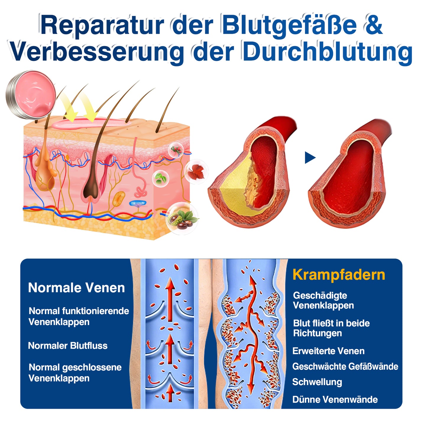 🇩🇪🎁GFOUK®VeinRenew Mikronadel-Balsam