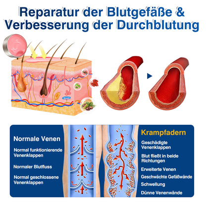 🇩🇪🎁GFOUK®VeinRenew Mikronadel-Balsam