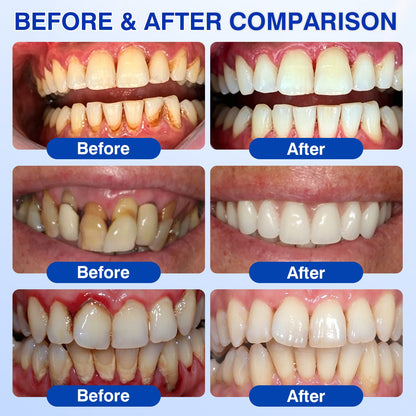 👨‍⚕️✅😁Evolvion® GumRevive Periodontal Repair Gel