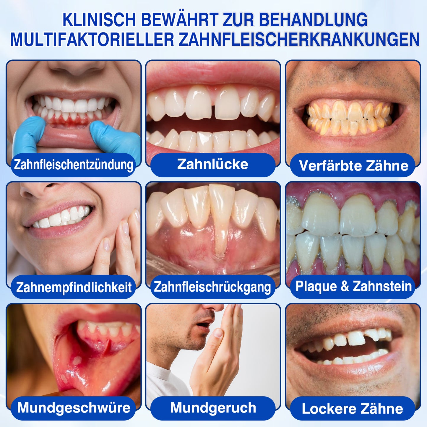 🇩🇪👨‍⚕️✅😁Evolvion® GumRevive Parodontales Reparaturgel