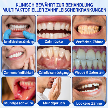 🇩🇪👨‍⚕️✅😁Evolvion® GumRevive Parodontales Reparaturgel