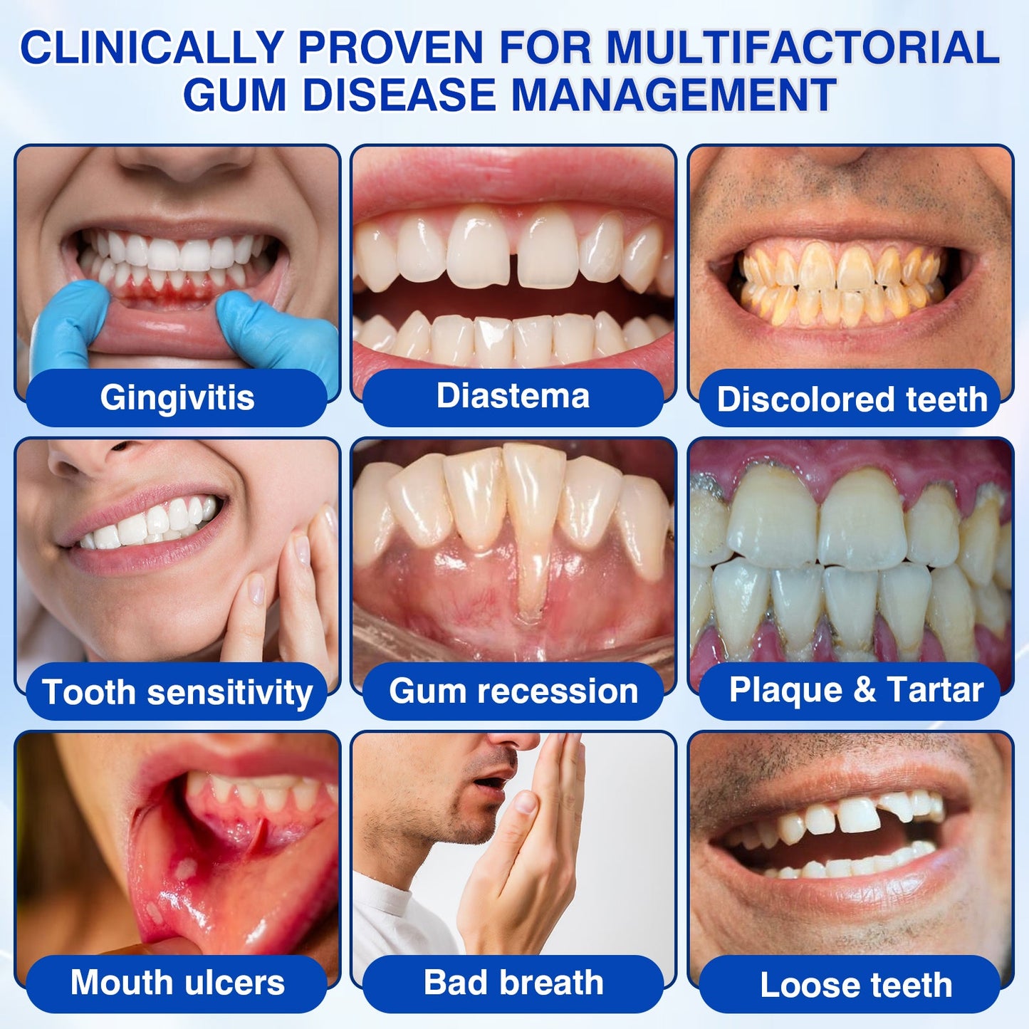 👨‍⚕️✅😁Evolvion® GumRevive Periodontal Repair Gel