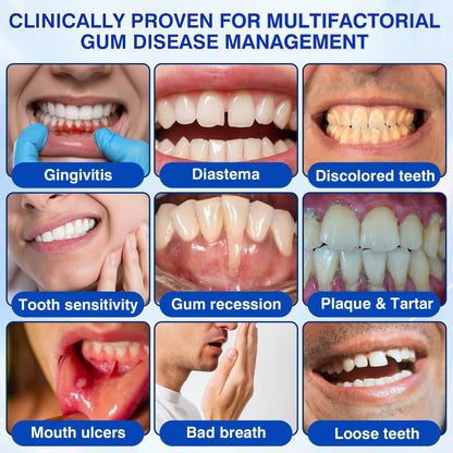 👨‍⚕️✅😁Evolvion® GumRevive Periodontal Repair Gel