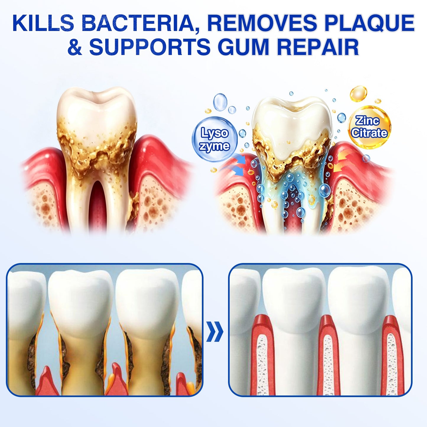 👨‍⚕️✅😁Evolvion® GumRevive Periodontal Repair Gel