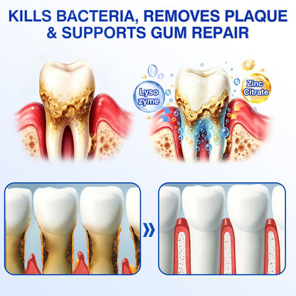 👨‍⚕️✅😁Evolvion® GumRevive Periodontal Repair Gel