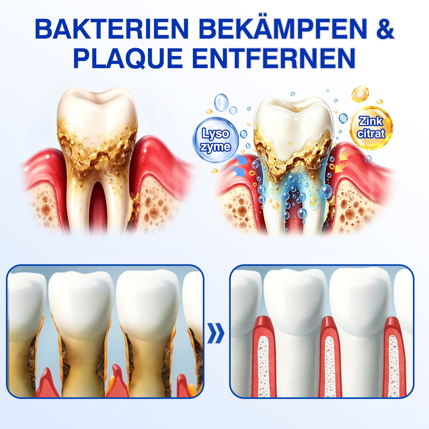 🇩🇪👨‍⚕️✅😁Evolvion® GumRevive Parodontales Reparaturgel