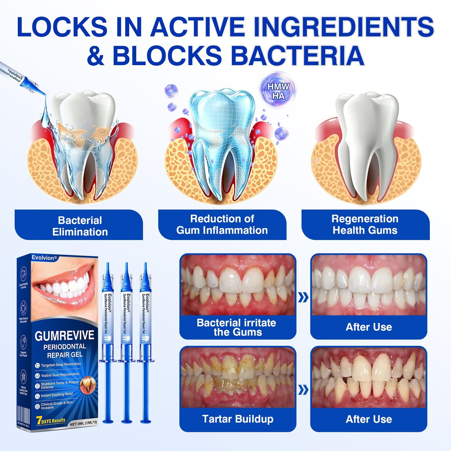 👨‍⚕️✅😁Evolvion® GumRevive Periodontal Repair Gel