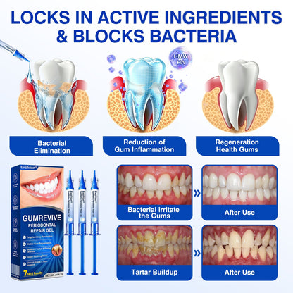 👨‍⚕️✅😁Evolvion® GumRevive Periodontal Repair Gel