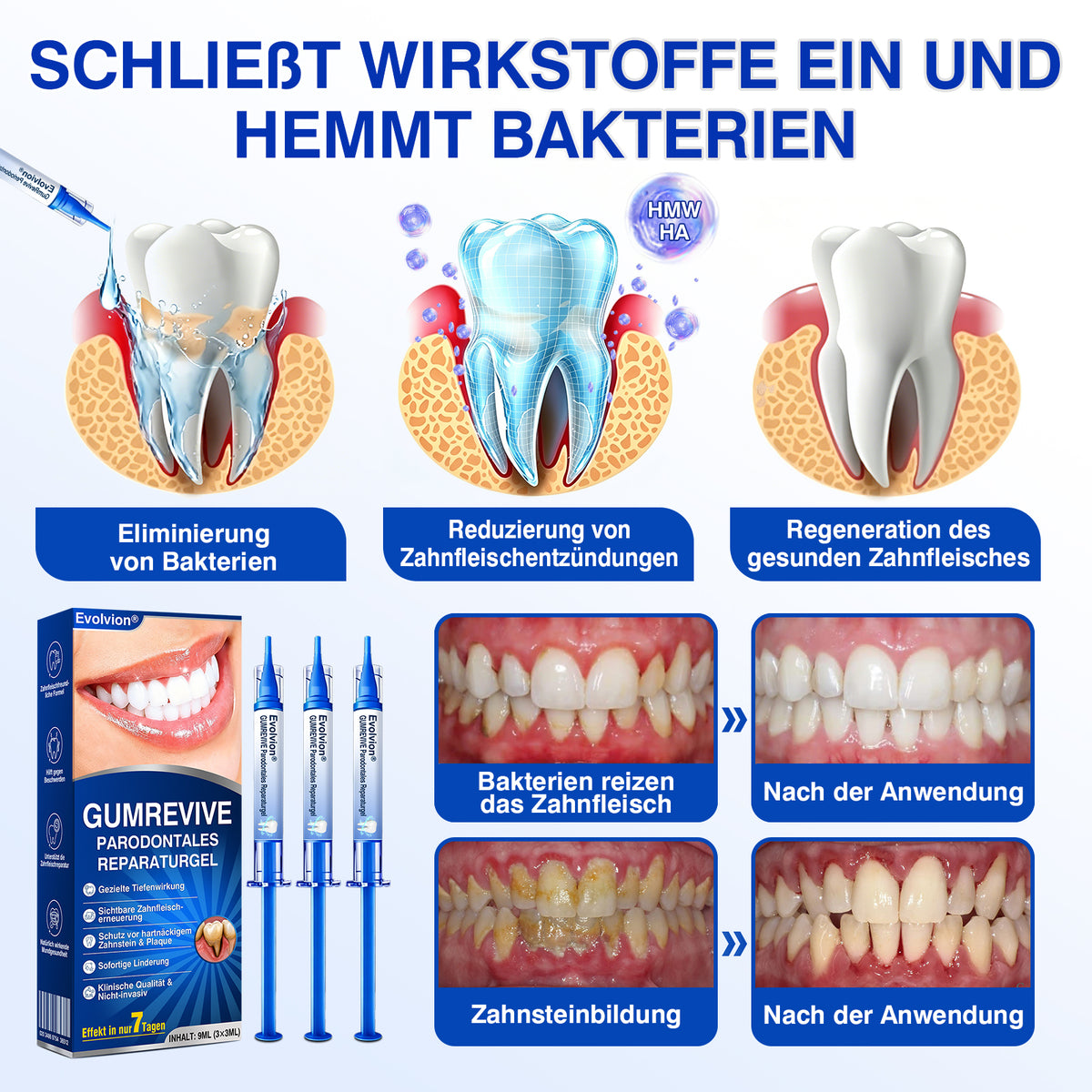 🇩🇪👨‍⚕️✅🦷Evolvion® GumRevive Parodontales Reparaturgel