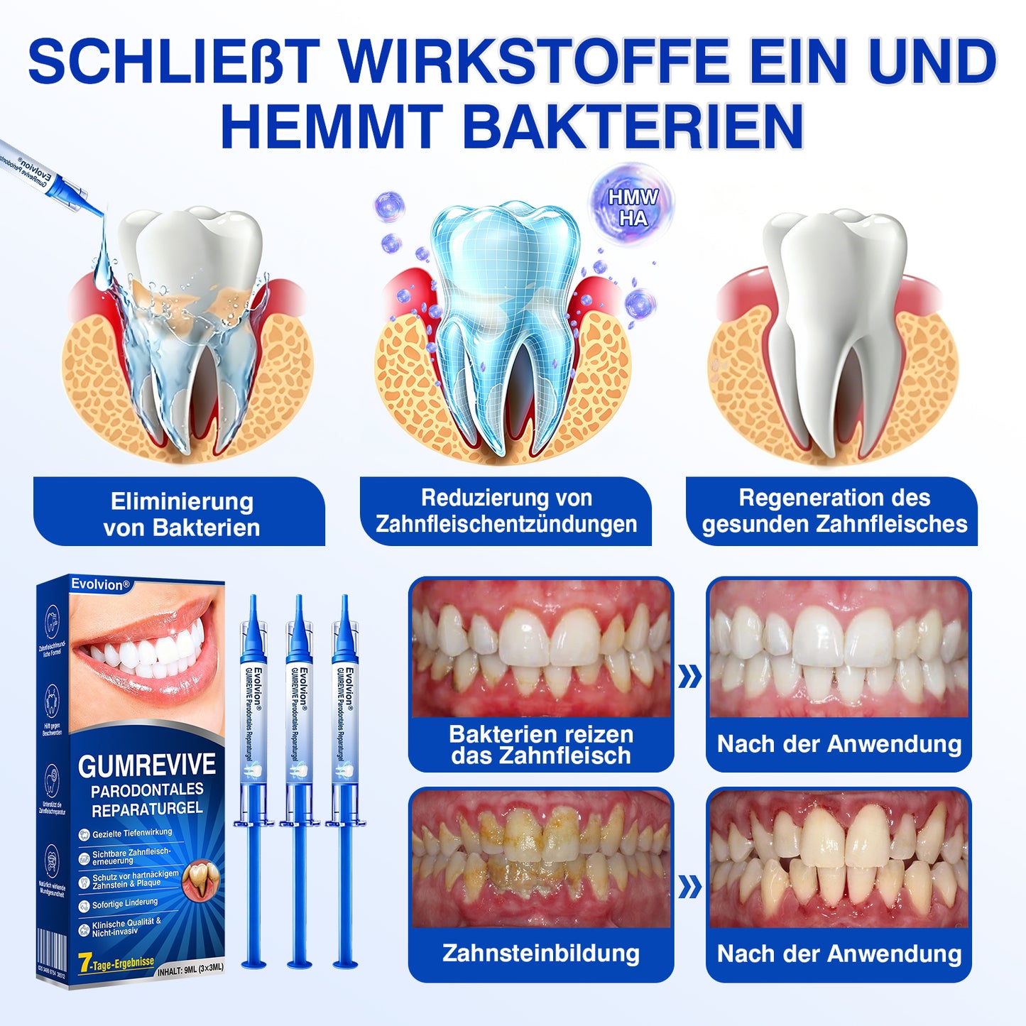 🇩🇪👨‍⚕️✅🦷Evolvion® GumRevive Parodontales Reparaturgel