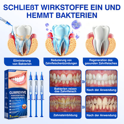 🇩🇪👨‍⚕️✅🦷Evolvion® GumRevive Parodontales Reparaturgel