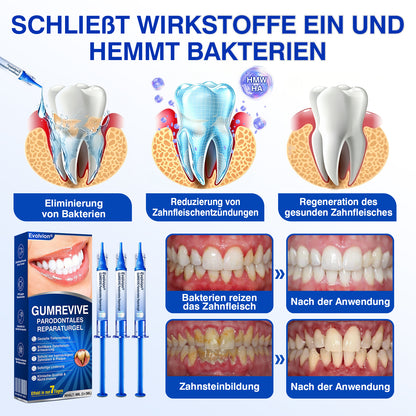 🇩🇪🏆🦷✨Evolvion® GumRevive Parodontales Reparaturgel