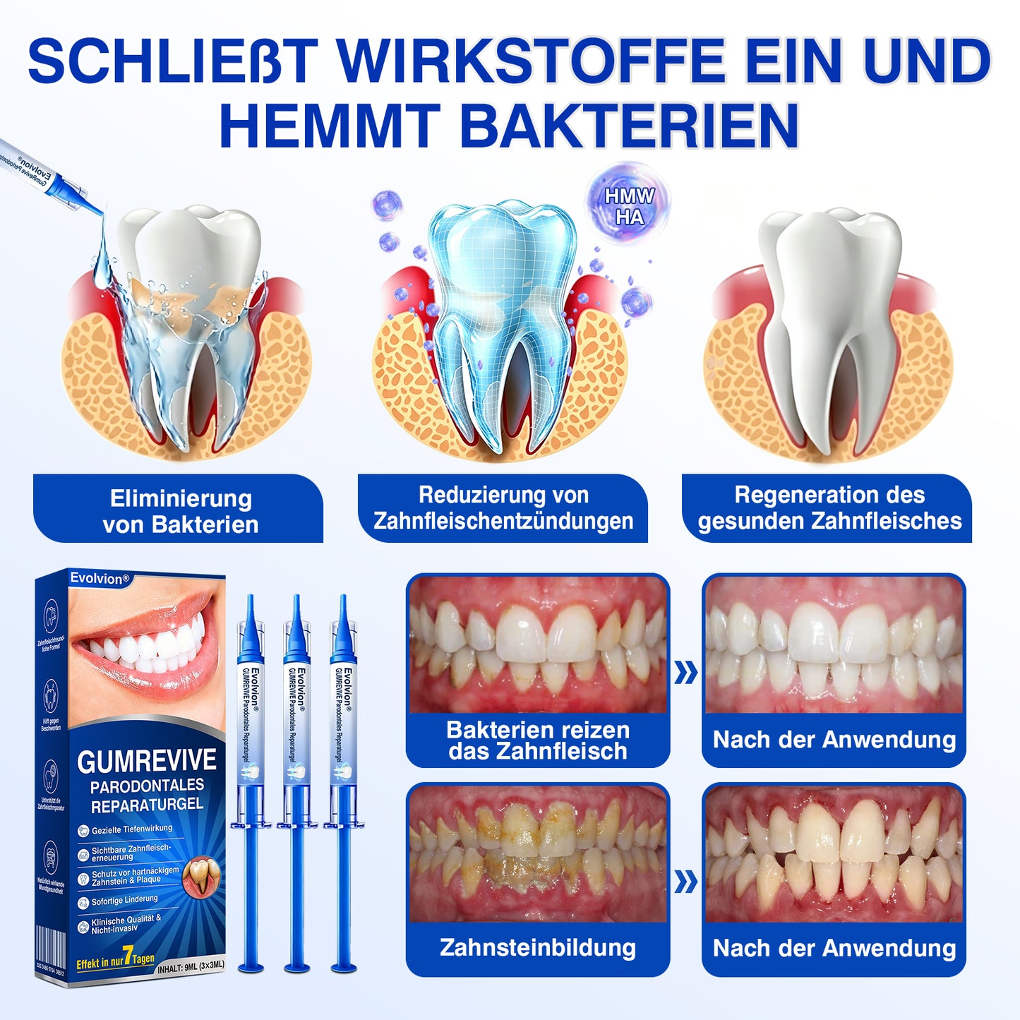🇩🇪🏆✅🦷Evolvion® GumRevive Parodontales Reparaturgel