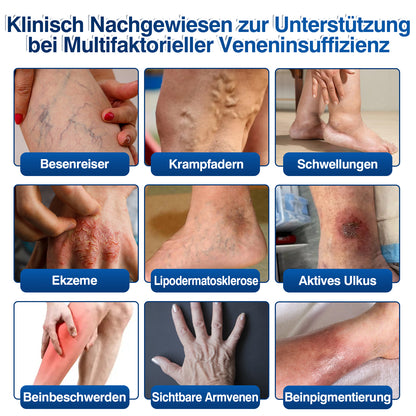 🇩🇪🎁GFOUK®VeinRenew Mikronadel-Balsam