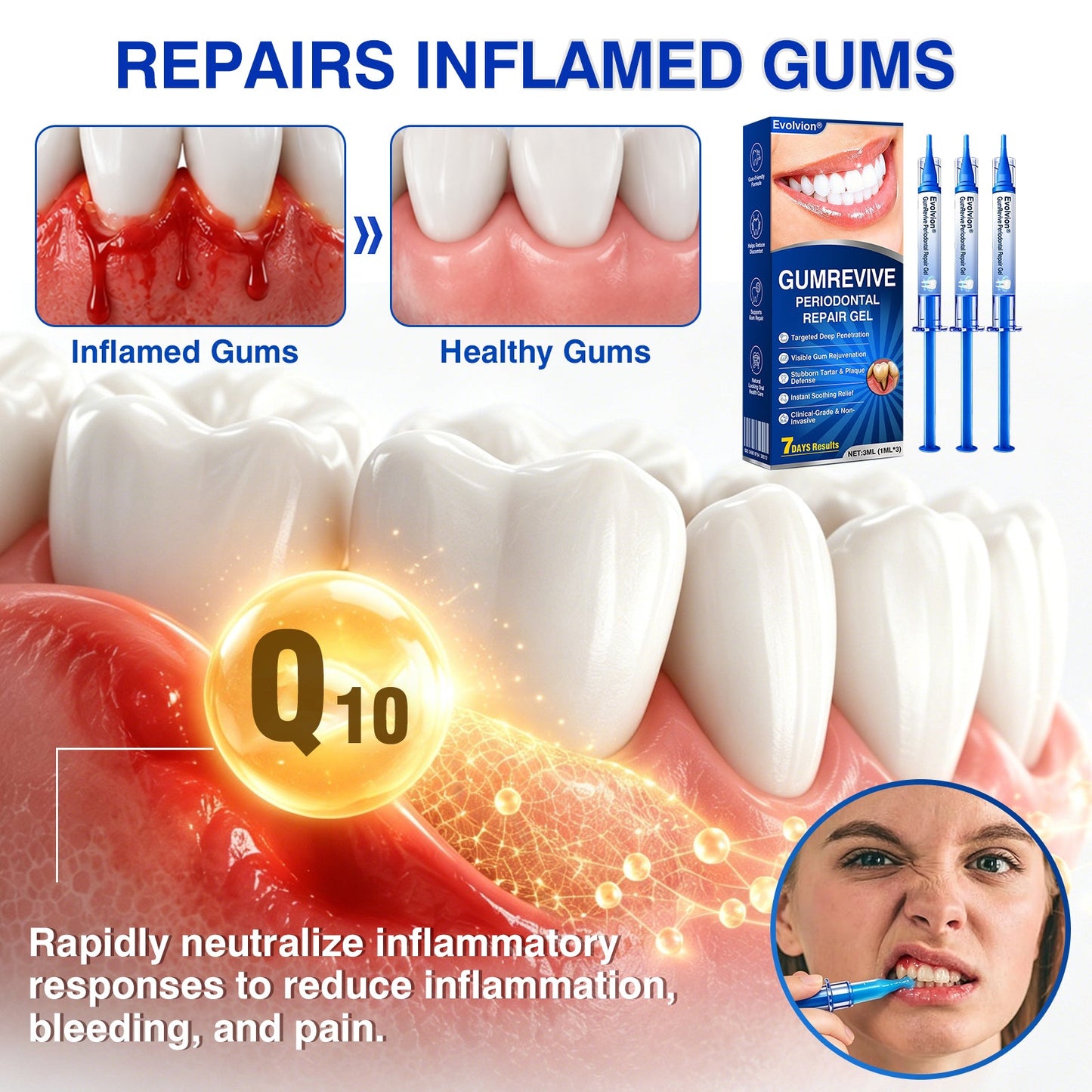 👨‍⚕️✅😁Evolvion® GumRevive Periodontal Repair Gel