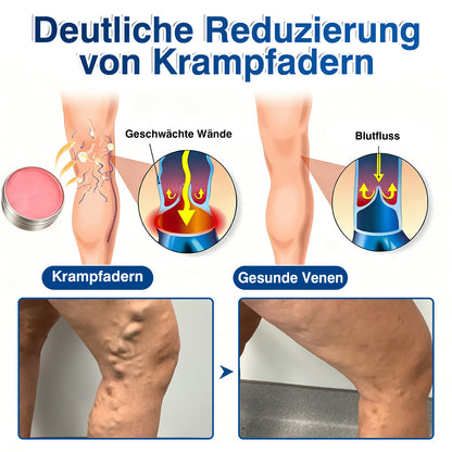 🇩🇪🎁GFOUK®VeinRenew Mikronadel-Balsam