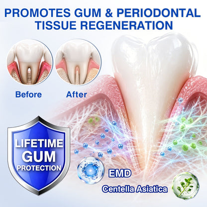 👨‍⚕️✅😁Evolvion® GumRevive Periodontal Repair Gel