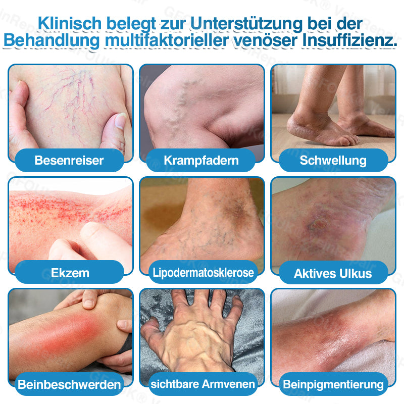 🇩🇪✅GFOUK® VeinRepair Mikronadel-Pflasterrolle⚡Sofortige Linderung, langfristige Ergebnisse
