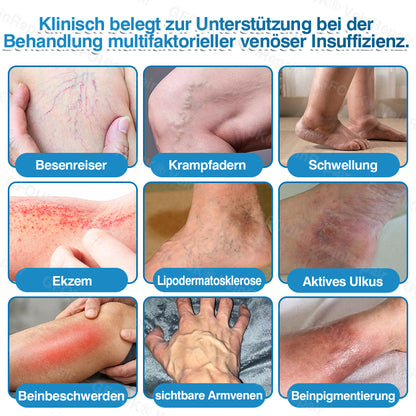 🇩🇪✅GFOUK® VeinRepair Mikronadel-Pflasterrolle⚡Sofortige Linderung, langfristige Ergebnisse