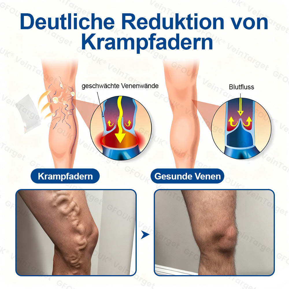 🇩🇪👨‍⚕️✅✅GFOUK® VeinTarget Mikronadel-Pflaster⚡Sofortige Linderung, langfristige Ergebnisse