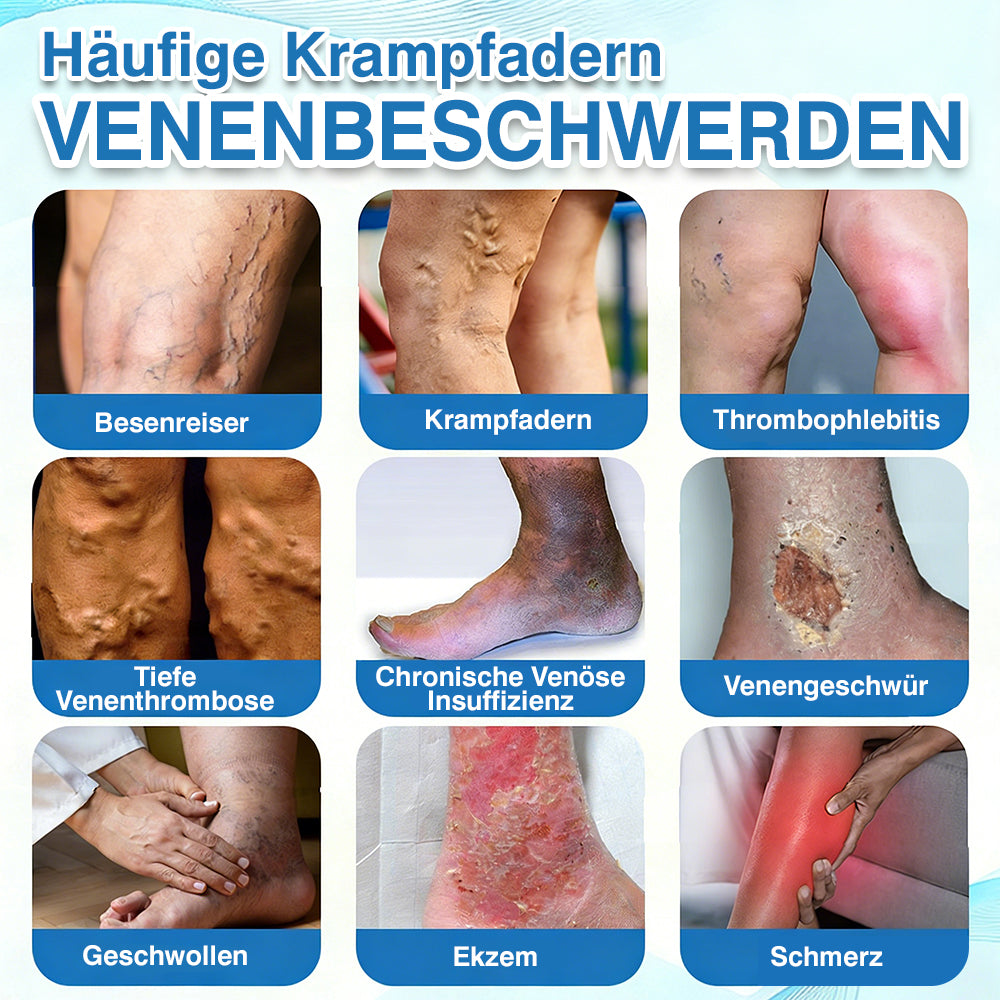 🇩🇪🎁GFOUK® VascuCare Vein Healing Spray(Entwickelt für Krampfadern, Besenreiser, tiefe Venenthrombose (TVT), chronische venöse Insuffizienz, venöse Geschwüre, Thrombophlebitis und andere venöse Beschwerden)