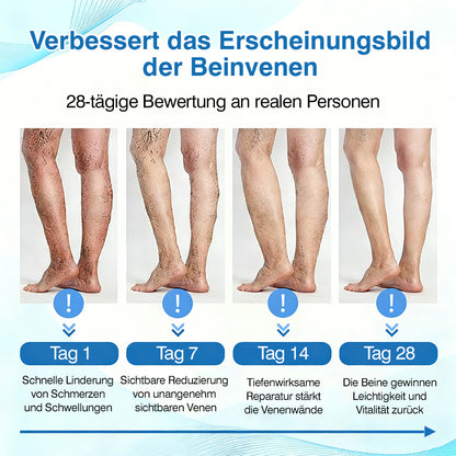 🇩🇪🎁GFOUK® VascuCare Vein Healing Spray(Entwickelt für Krampfadern, Besenreiser, tiefe Venenthrombose (TVT), chronische venöse Insuffizienz, venöse Geschwüre, Thrombophlebitis und andere venöse Beschwerden)