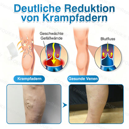🇩🇪✅GFOUK® VeinRepair Mikronadel-Pflasterrolle⚡Sofortige Linderung, langfristige Ergebnisse